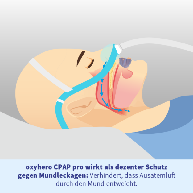 oxyhero CPAP pro Schildschiene gegen Mundleckagen 2